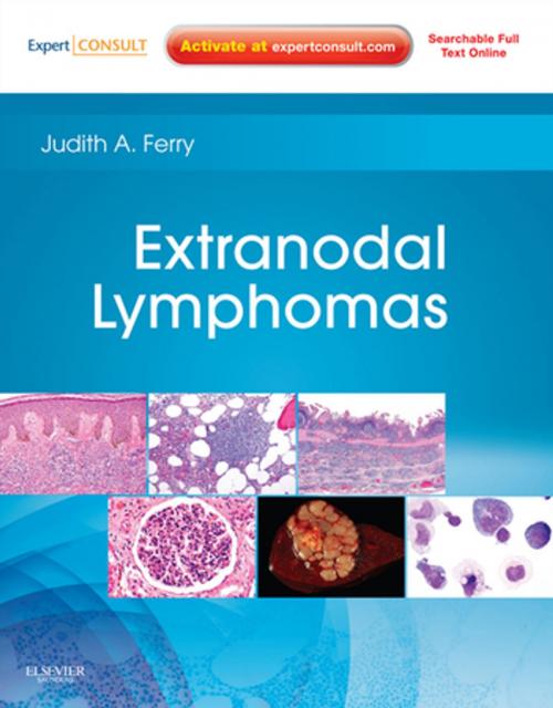 Cover of the book Extranodal Lymphomas E-Book by Judith A. Ferry, MD, Elsevier Health Sciences