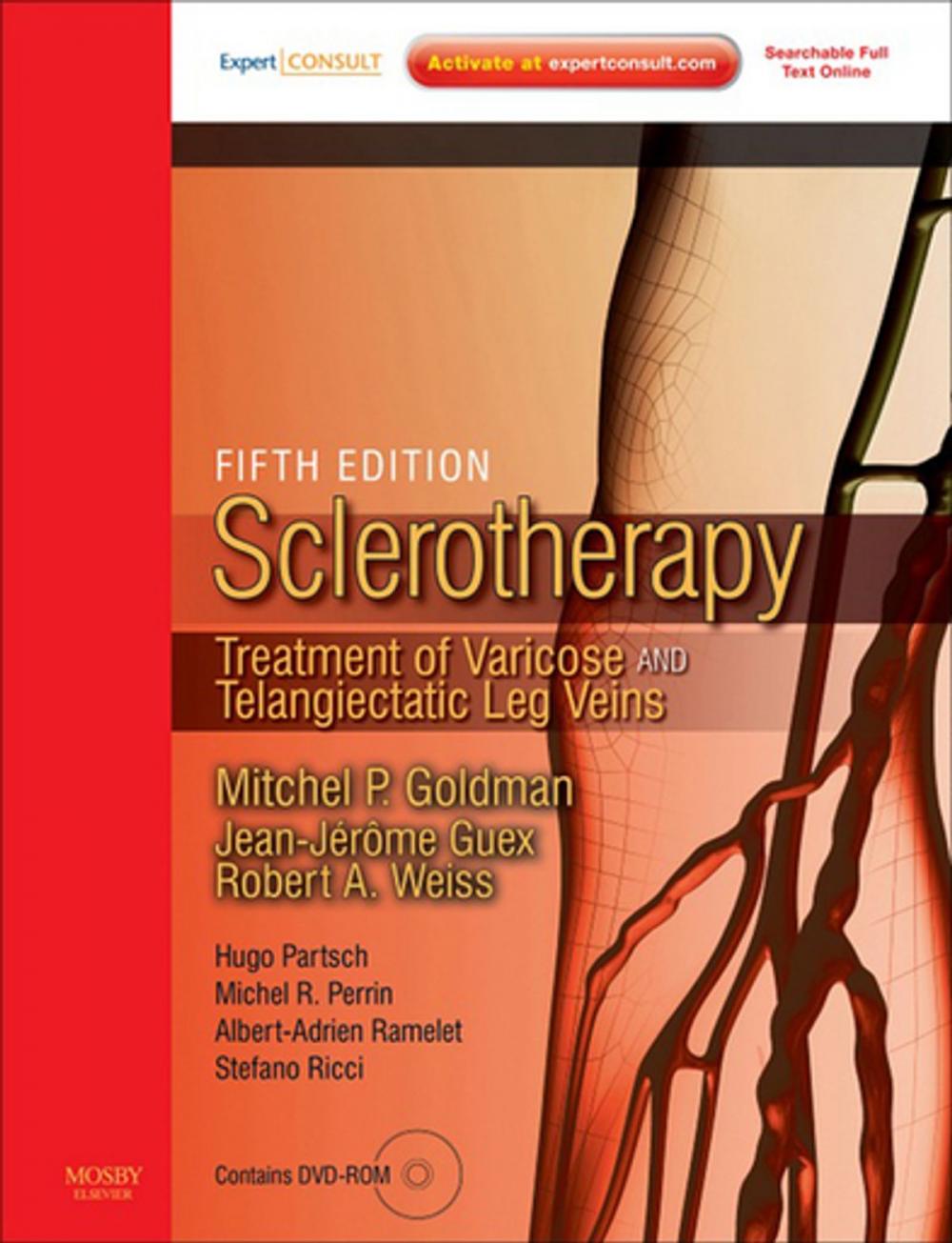 Big bigCover of Sclerotherapy E-Book