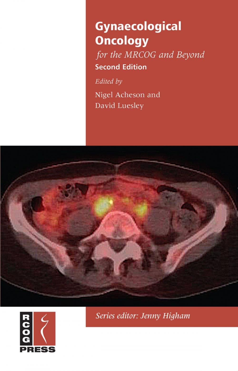 Big bigCover of Gynaecological Oncology for the MRCOG and Beyond