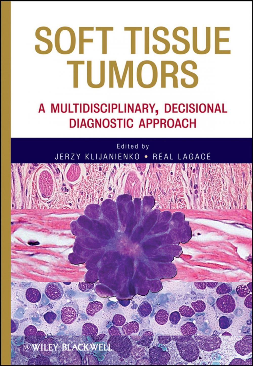 Big bigCover of Soft Tissue Tumors