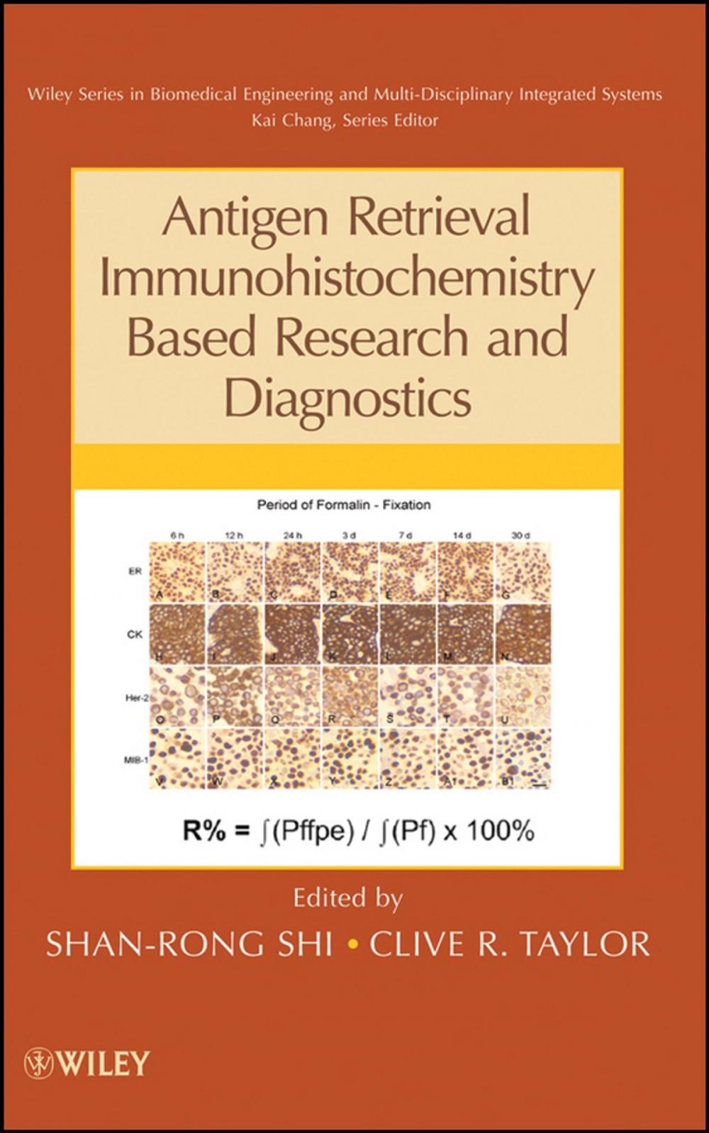 Big bigCover of Antigen Retrieval Immunohistochemistry Based Research and Diagnostics