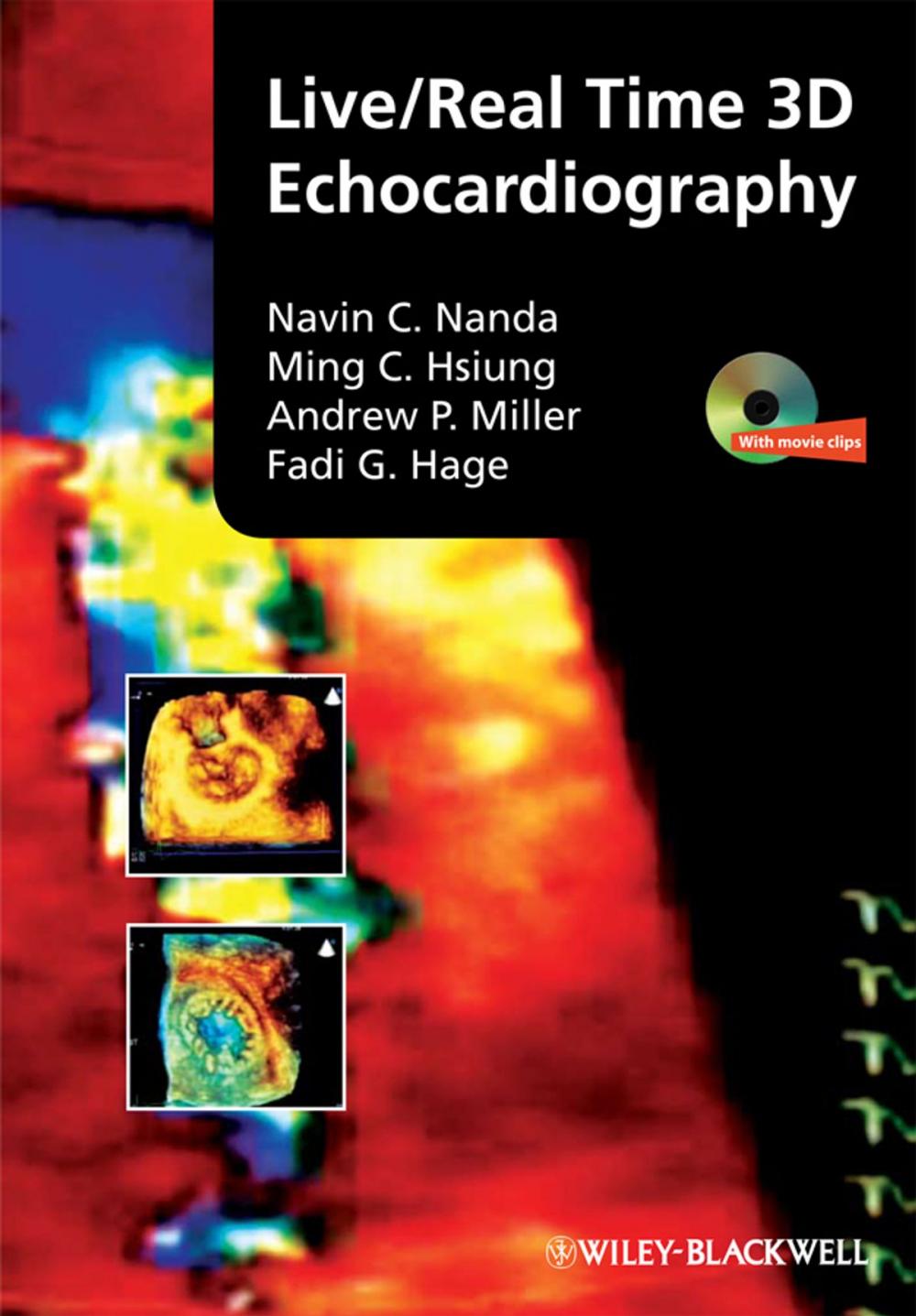 Big bigCover of Live/Real Time 3D Echocardiography