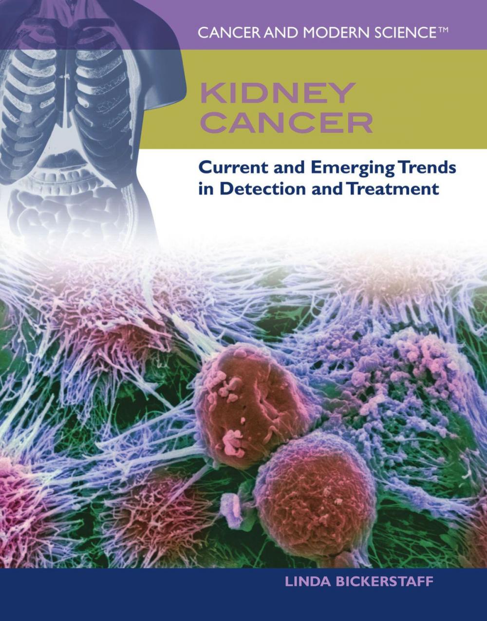 Big bigCover of Kidney Cancer