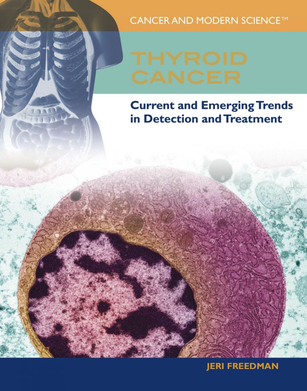 Big bigCover of Thyroid Cancer