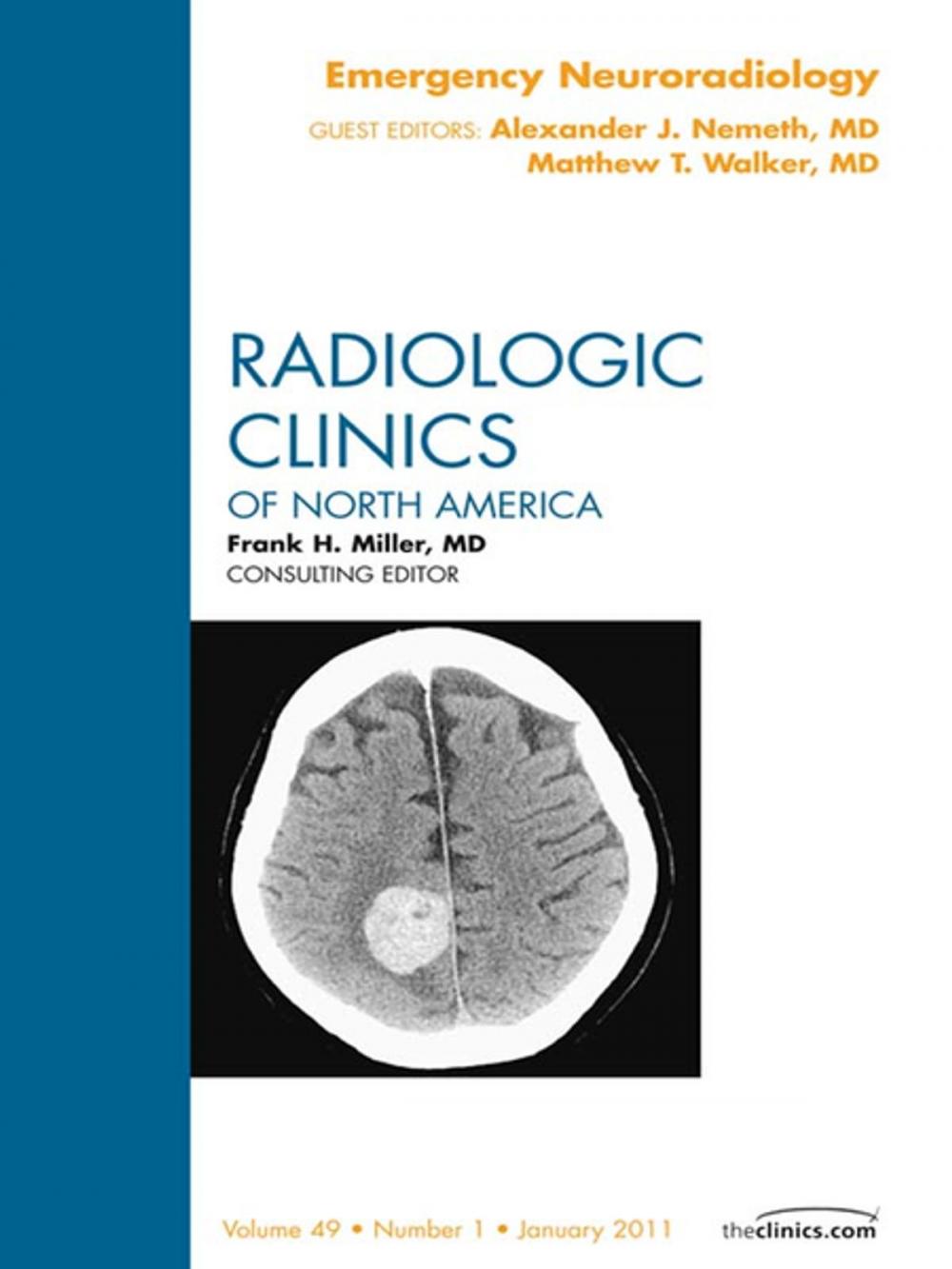 Big bigCover of Emergency Neuroradiology, An Issue of Radiologic Clinics of North America - E-Book