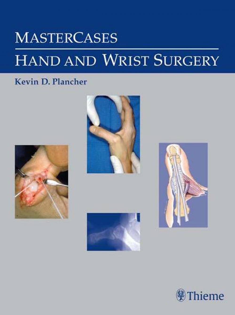 Big bigCover of MasterCases in Hand and Wrist Surgery