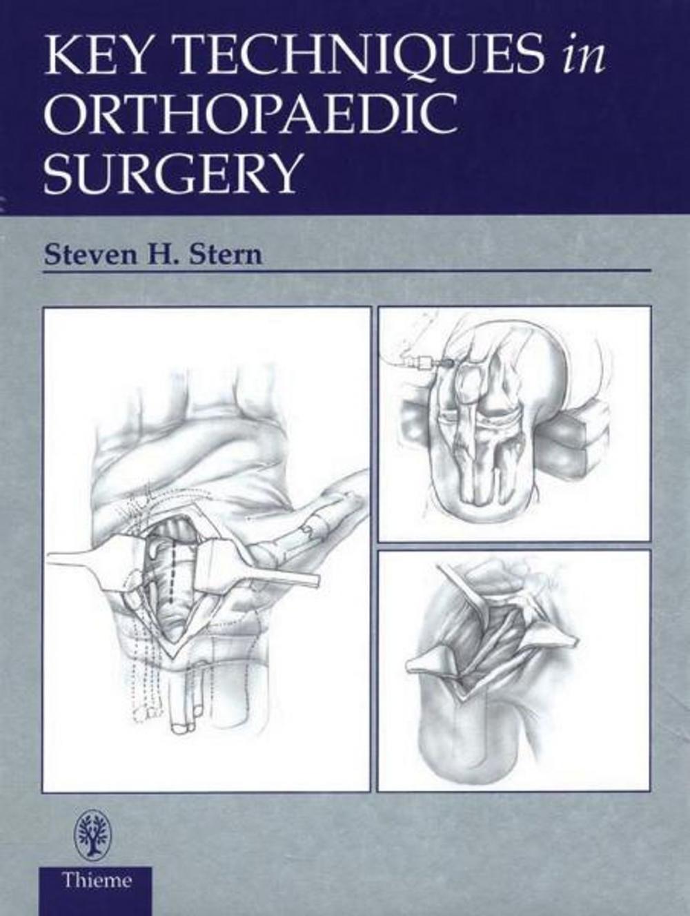 Big bigCover of Key Techniques in Orthopaedic Surgery