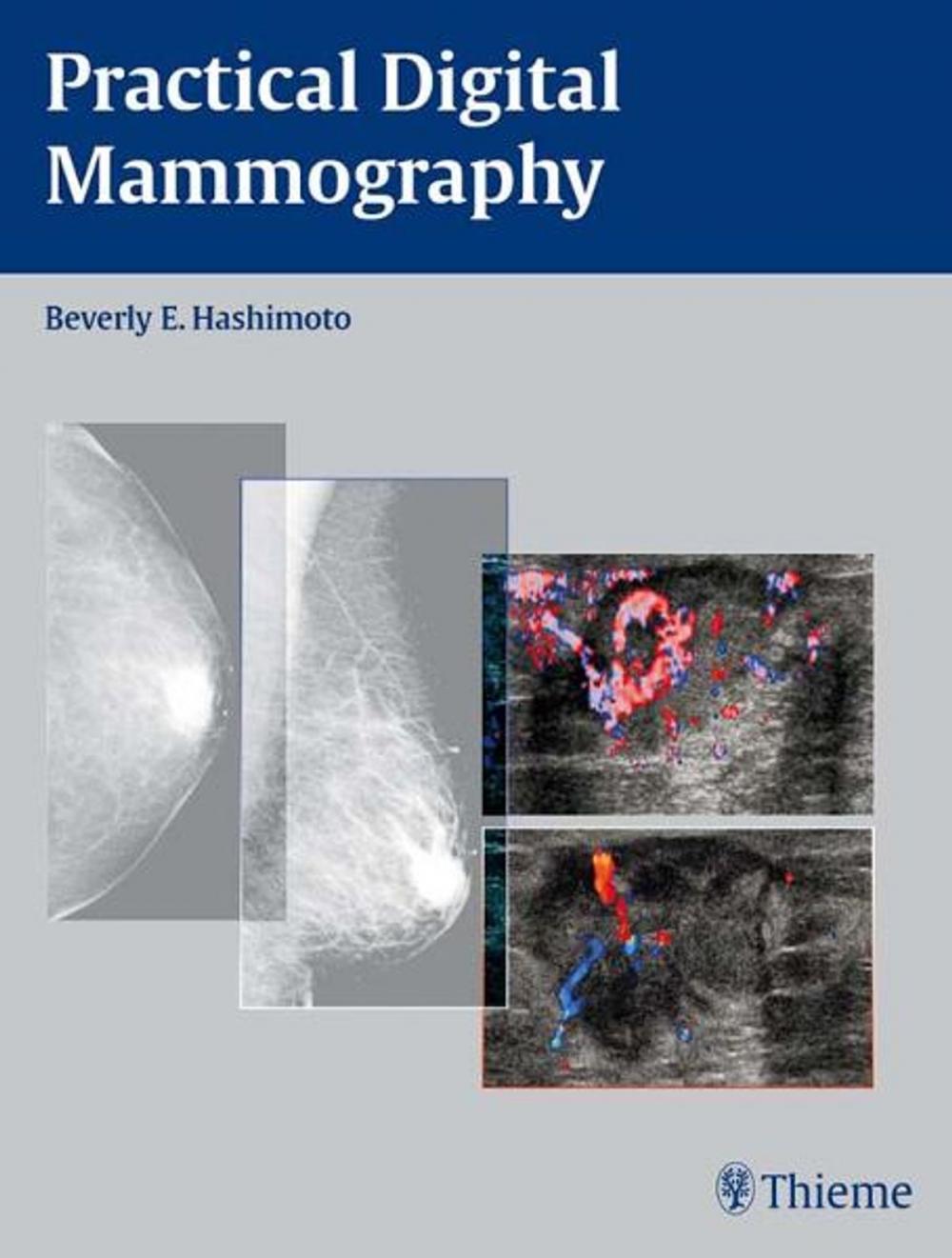 Big bigCover of Practical Digital Mammography