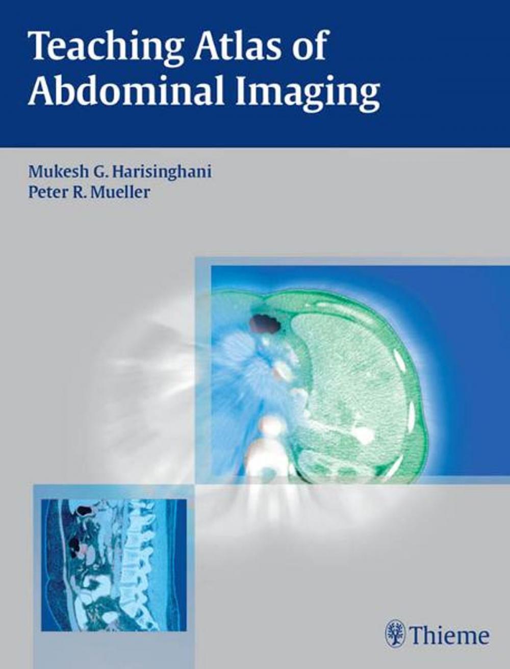 Big bigCover of Teaching Atlas of Abdominal Imaging