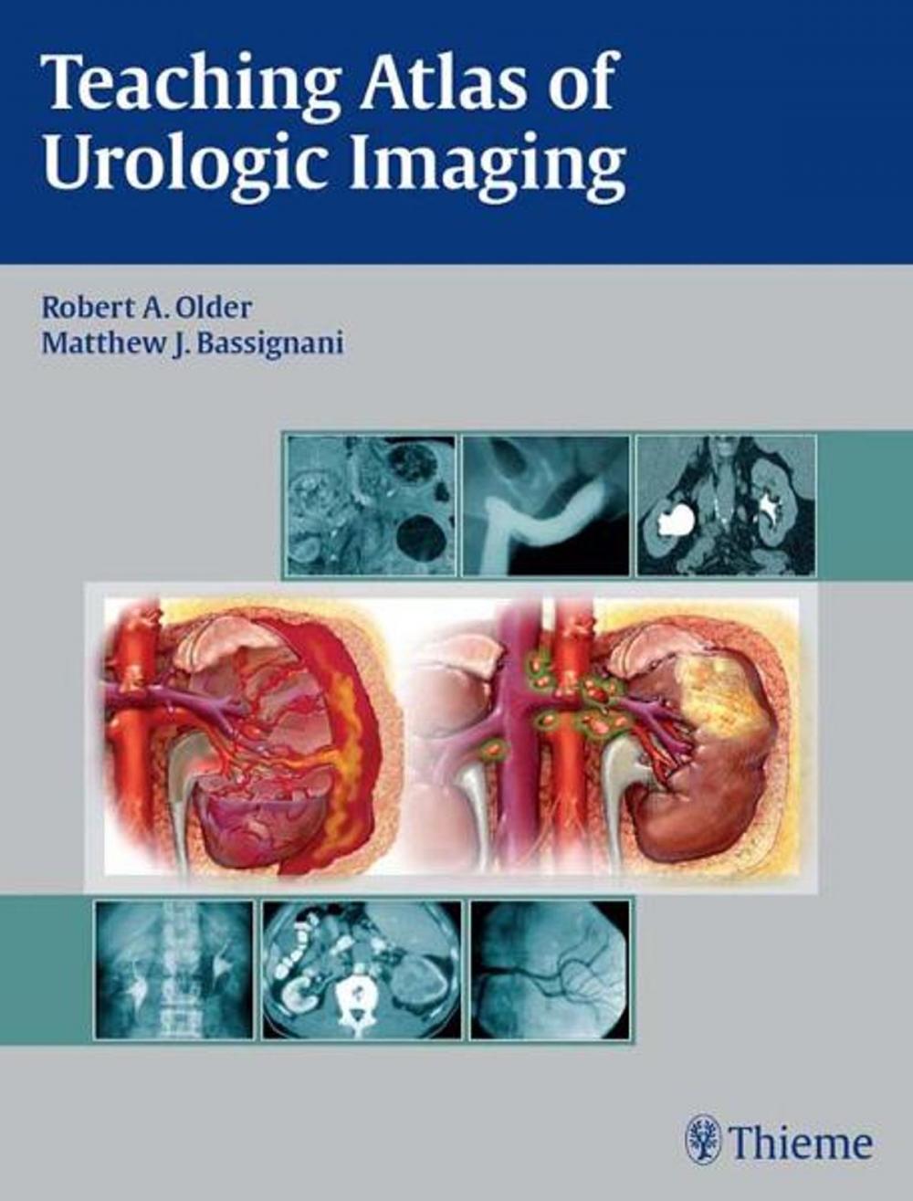 Big bigCover of Teaching Atlas of Urologic Imaging