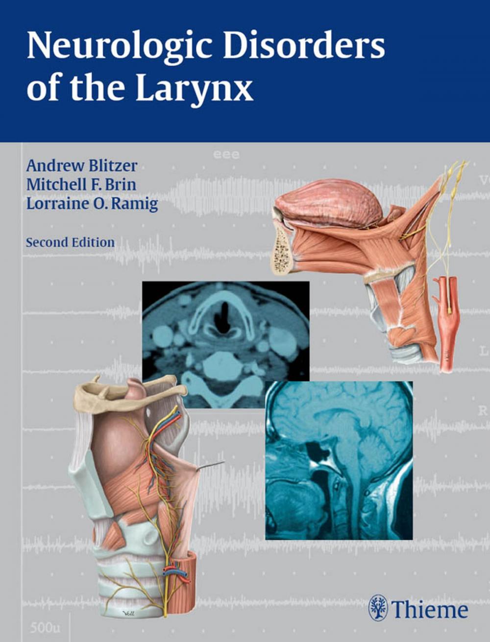 Big bigCover of Neurologic Disorders of the Larynx