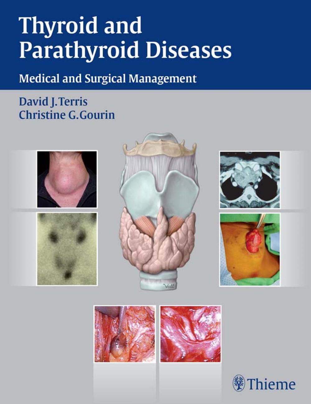 Big bigCover of Thyroid and Parathyroid Diseases