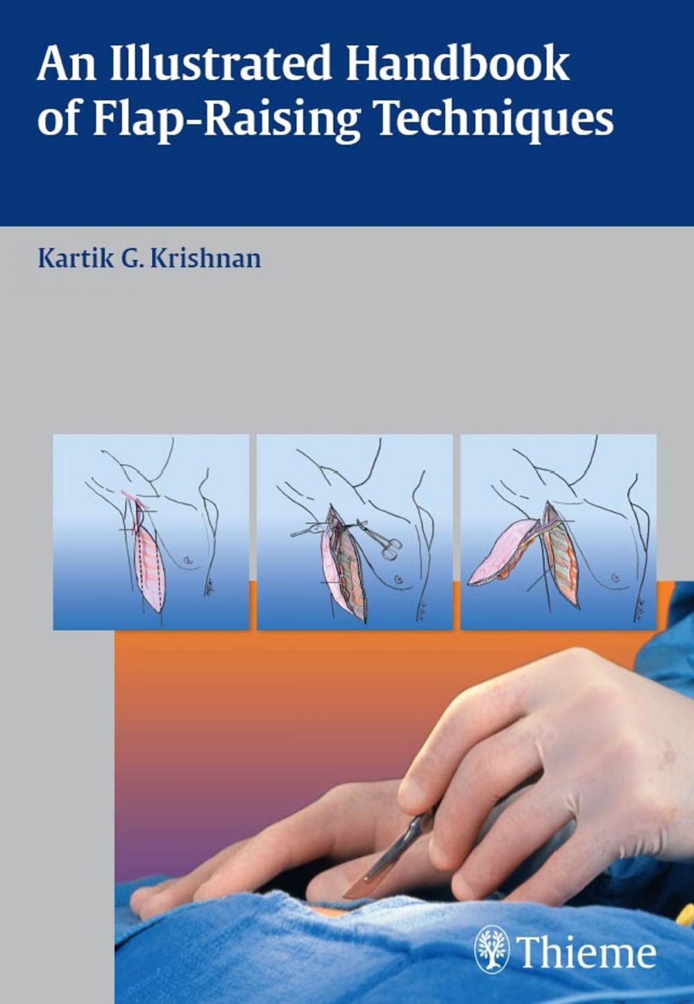 Big bigCover of Illustrated Handbook of Flap-Raising Techniques