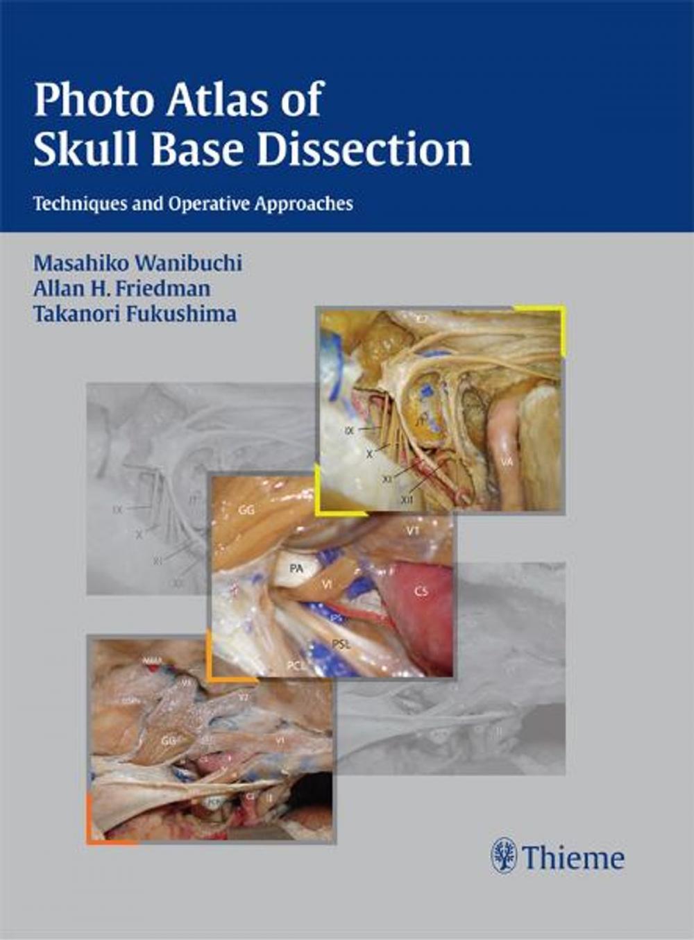 Big bigCover of Photo Atlas of Skull Base Dissection