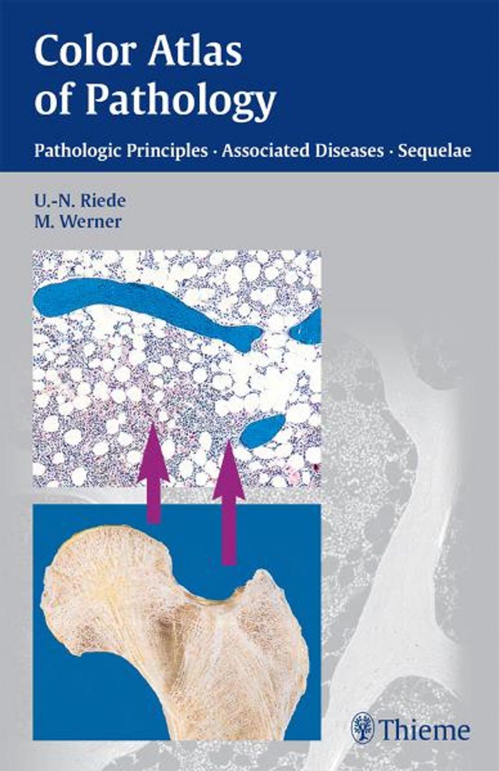 Big bigCover of Color Atlas of Pathology