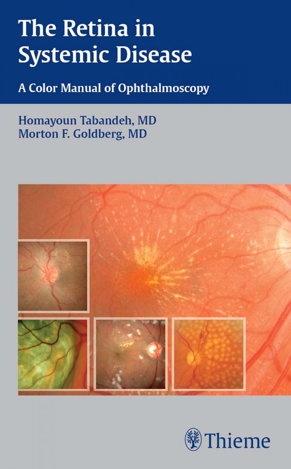 Big bigCover of The Retina in Systemic Disease