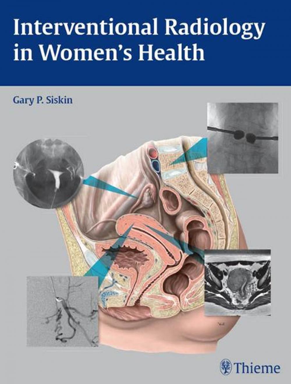 Big bigCover of Interventional Radiology in Women's Health