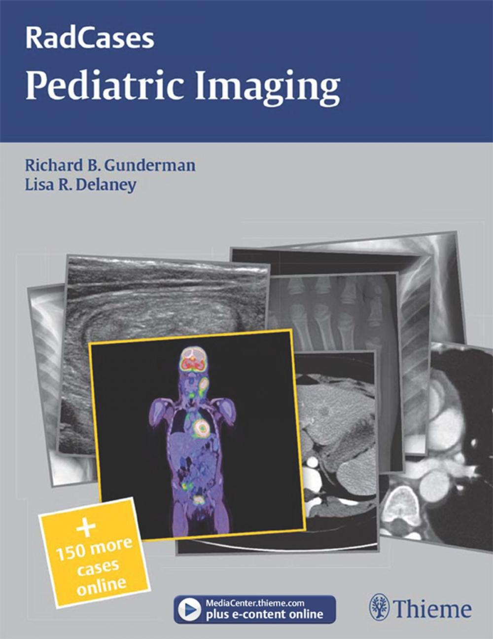 Big bigCover of Pediatric Imaging