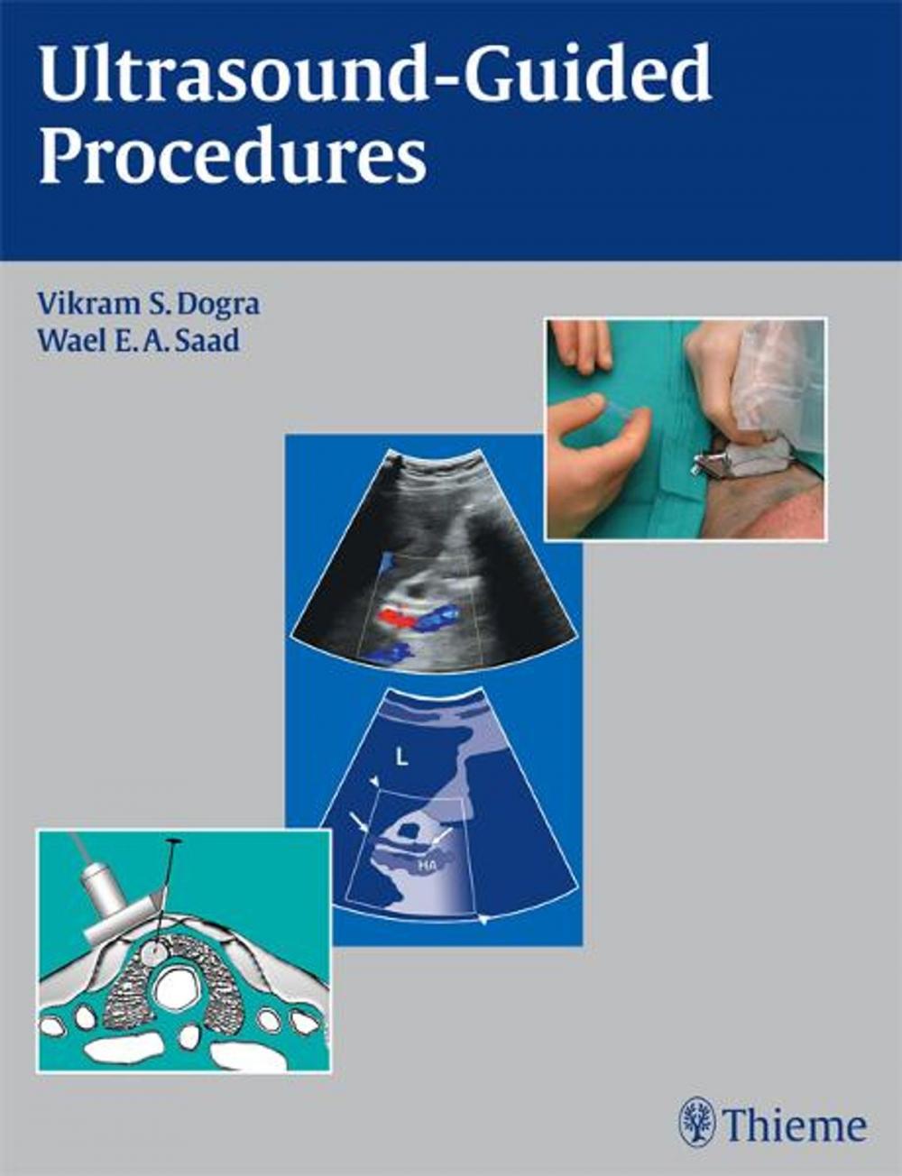 Big bigCover of Ultrasound-Guided Procedures