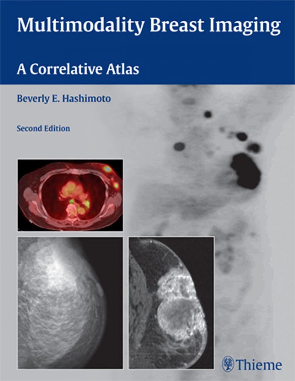 Big bigCover of Multimodality Breast Imaging