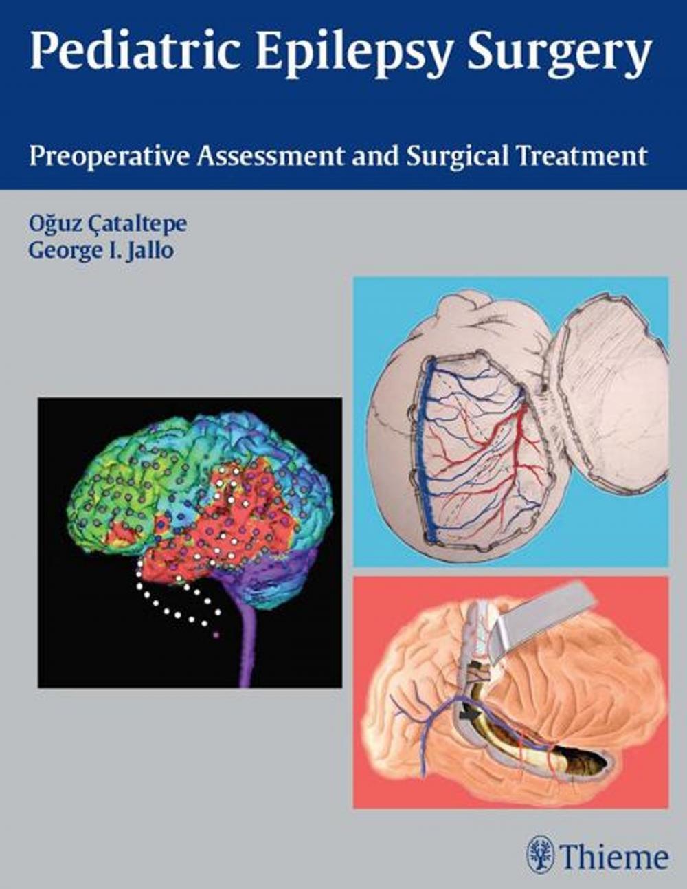 Big bigCover of Pediatric Epilepsy Surgery