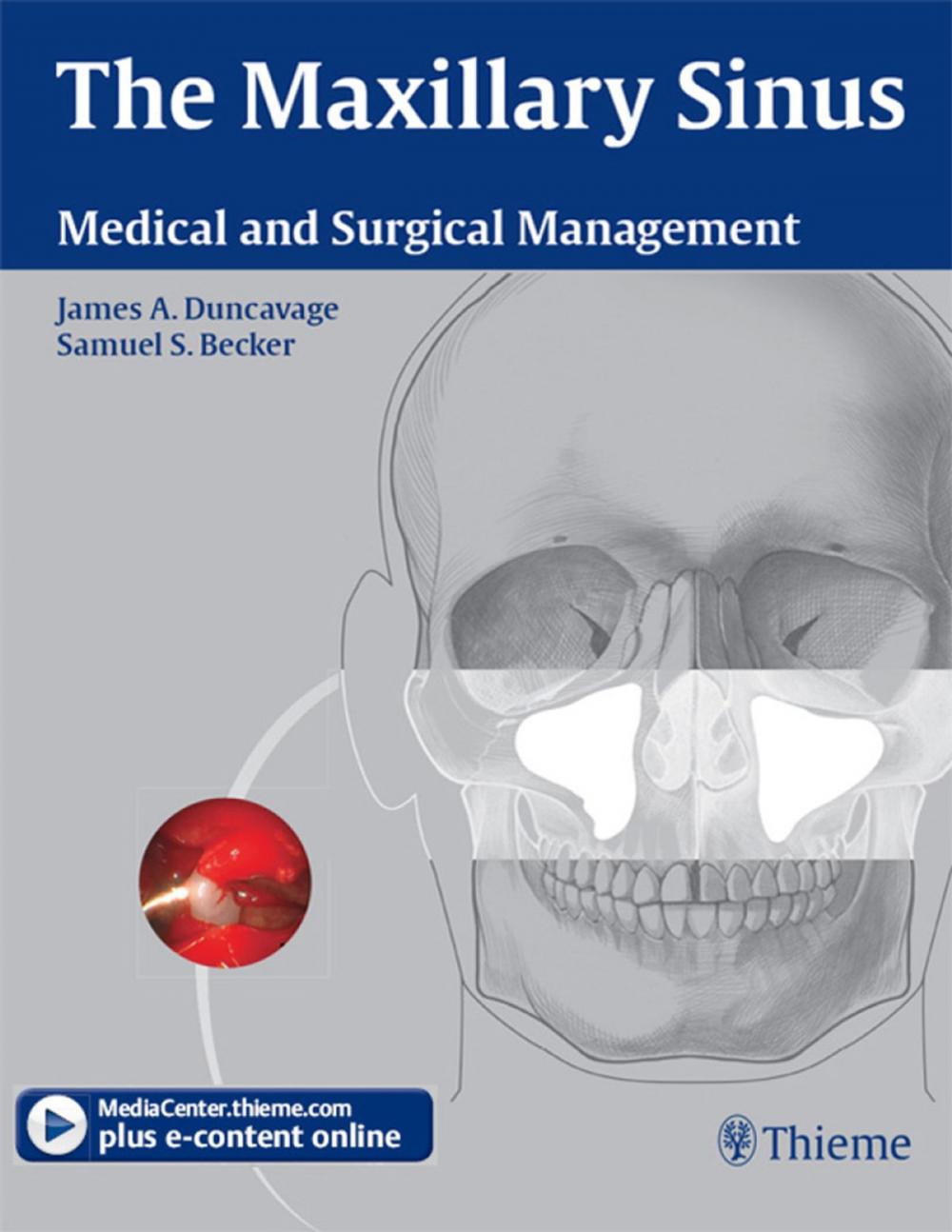 Big bigCover of Maxillary Sinus