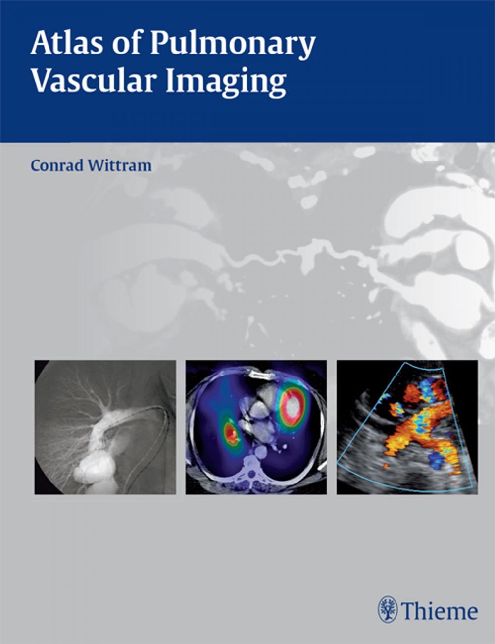 Big bigCover of Atlas of Pulmonary Vascular Imaging