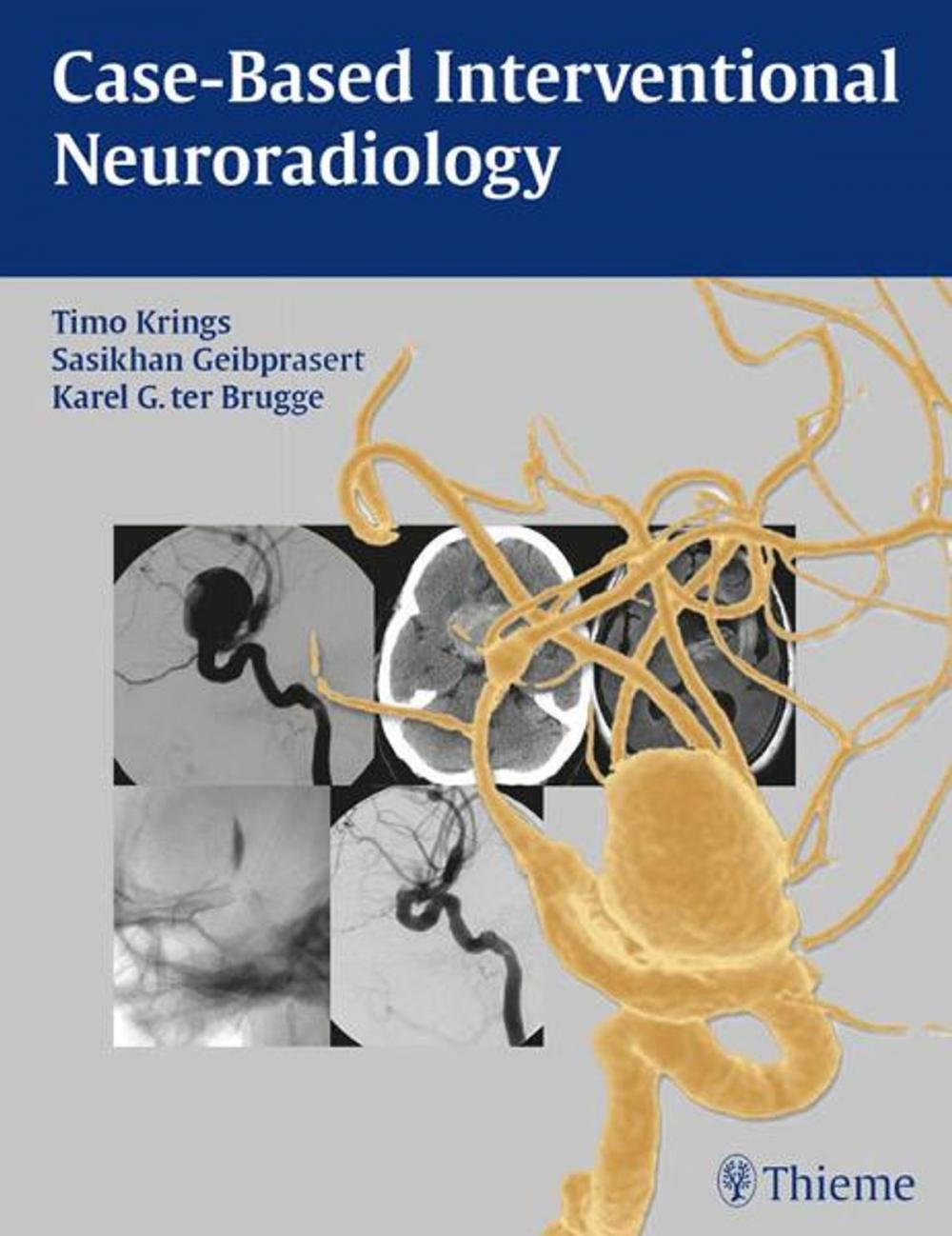 Big bigCover of Case-Based Interventional Neuroradiology