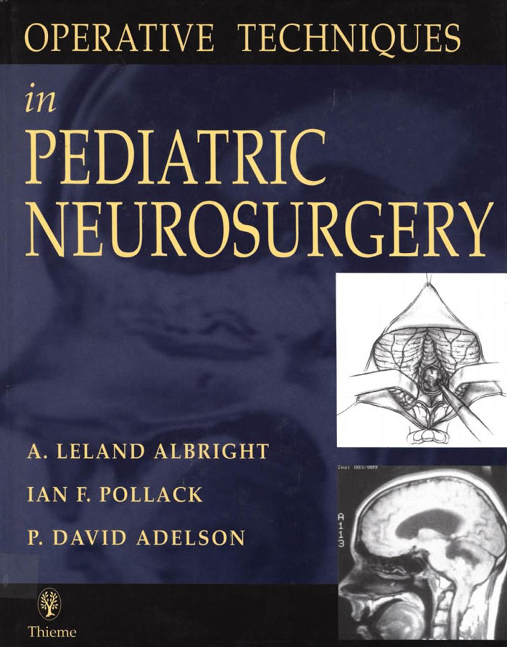 Big bigCover of Operative Techniques in Pediatric Neurosurgery