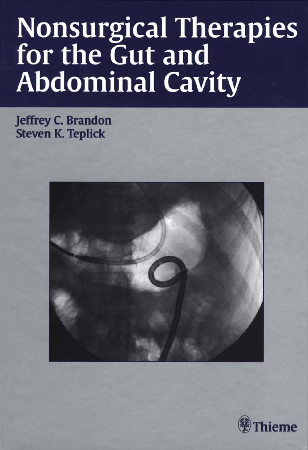 Big bigCover of Nonsurgical Therapies for the Gut and Abdominal Cavity