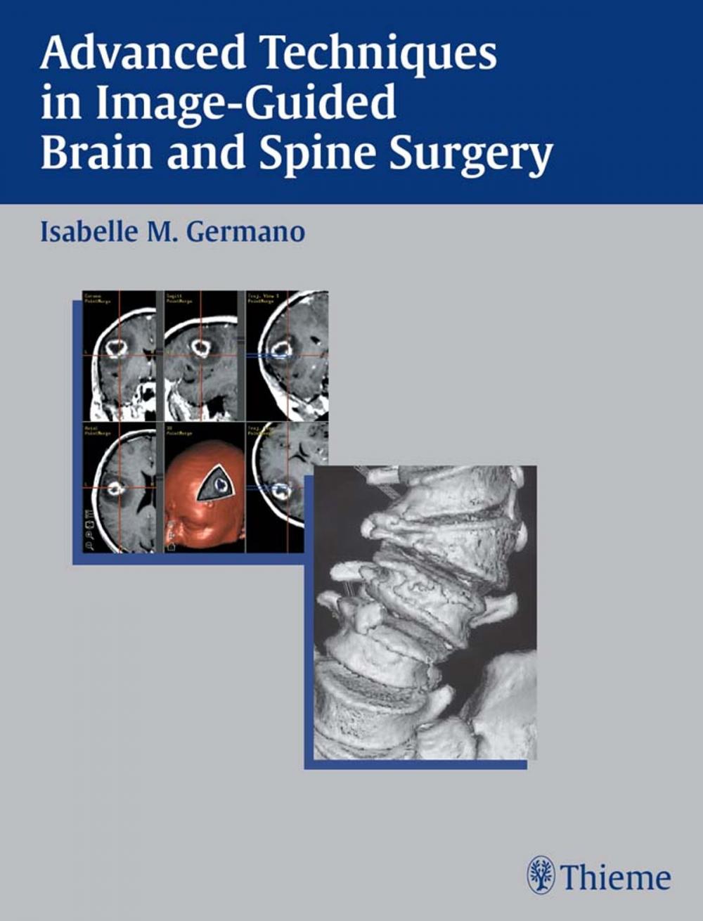 Big bigCover of Advanced Techniques in Image-Guided Brain and Spine Surgery