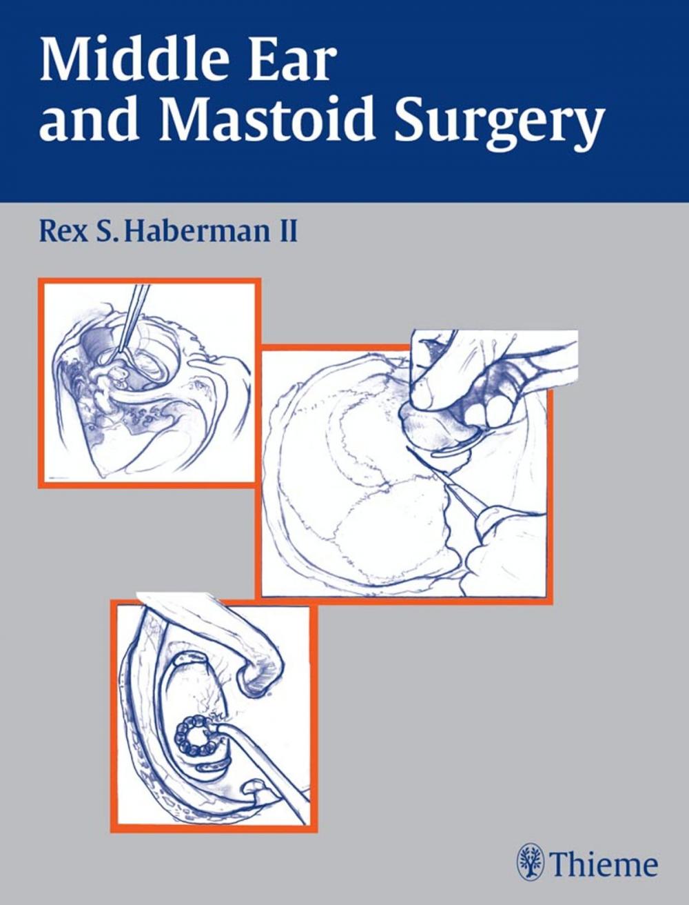 Big bigCover of Middle Ear and Mastoid Surgery