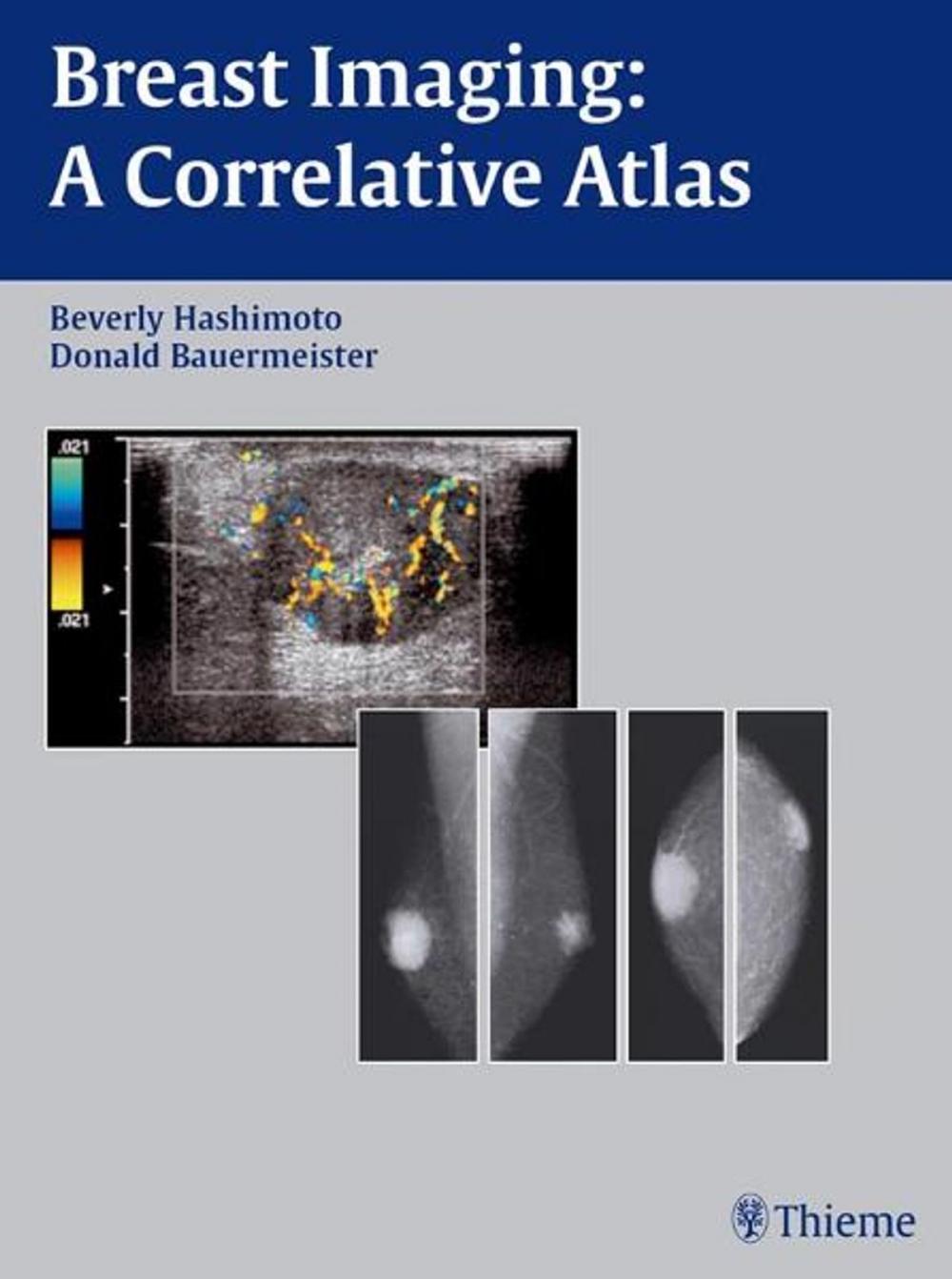 Big bigCover of Breast Imaging