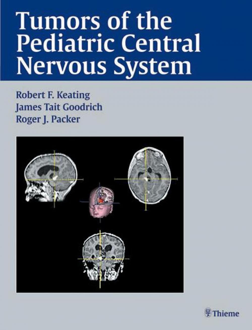 Big bigCover of Tumors of the Pediatric Central Nervous System