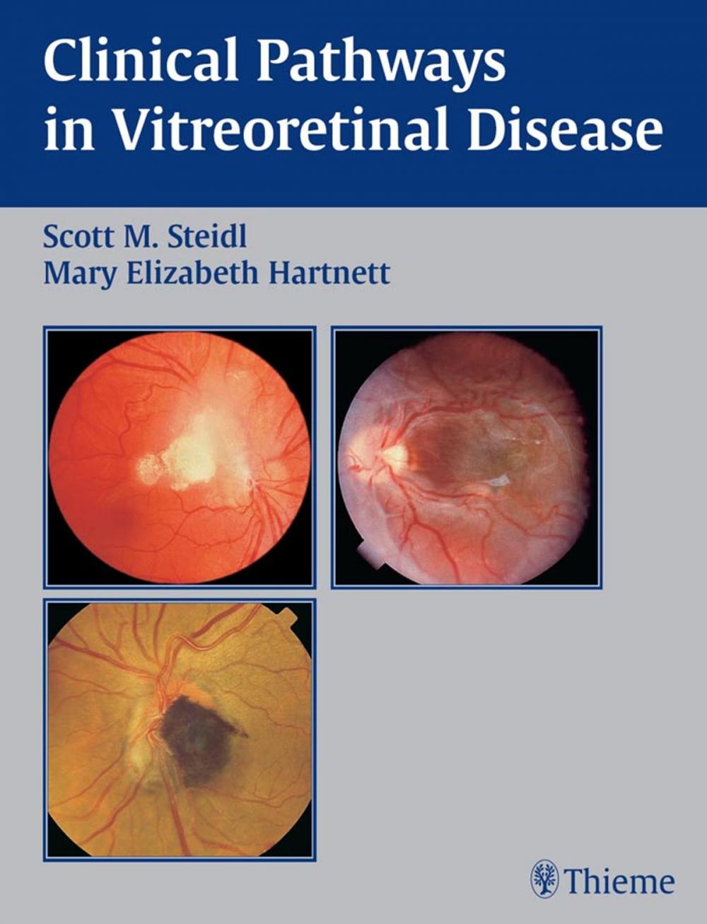 Big bigCover of Clinical Pathways In Vitreoretinal Disease