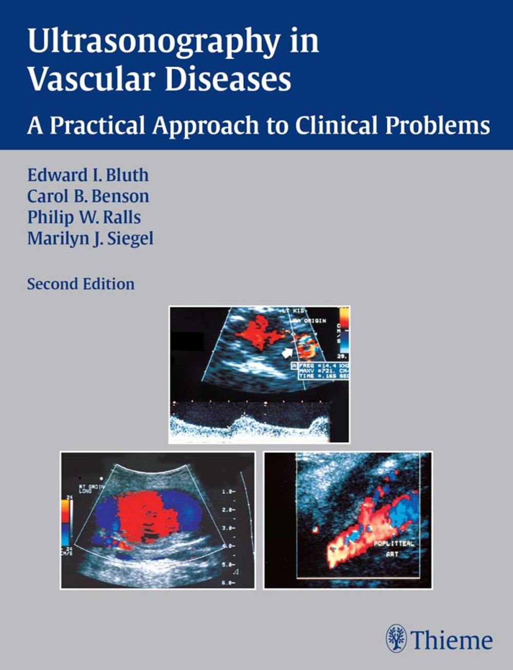 Big bigCover of Ultrasonography in Vascular Diseases