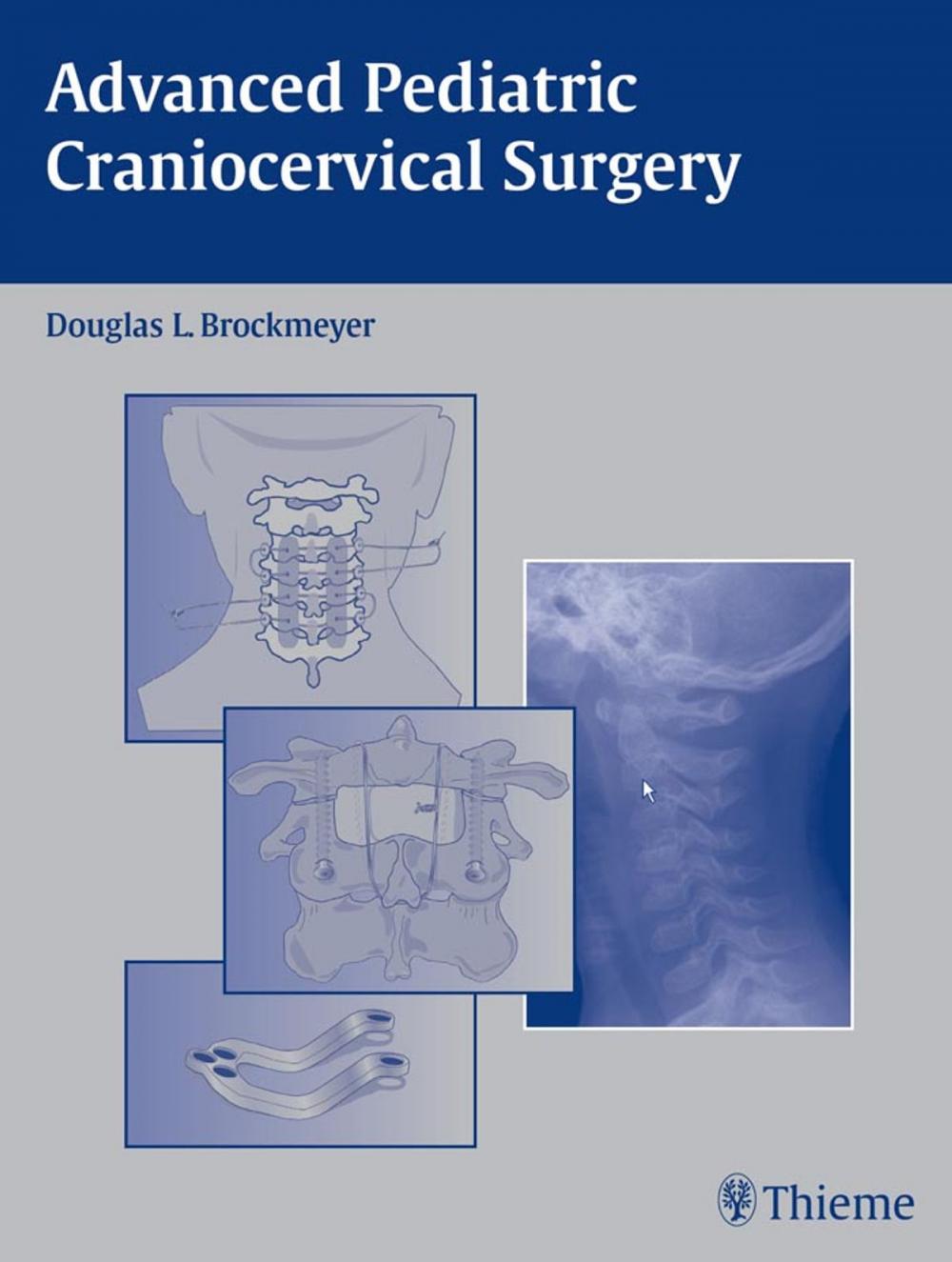 Big bigCover of Advanced Pediatric Craniocervical Surgery