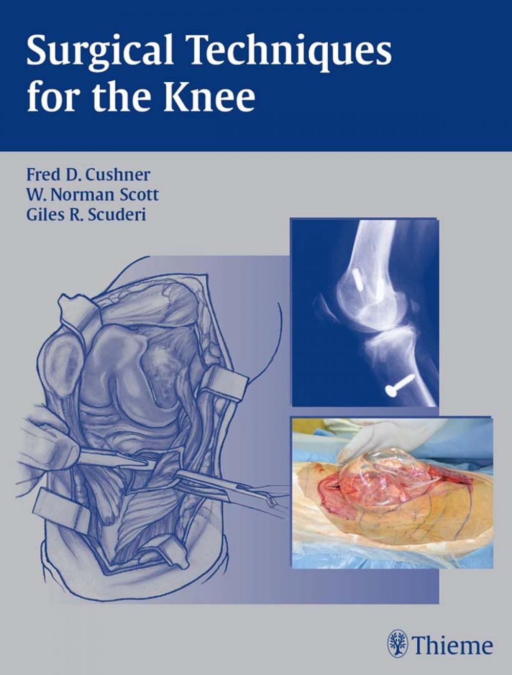 Big bigCover of Surgical Techniques for the Knee