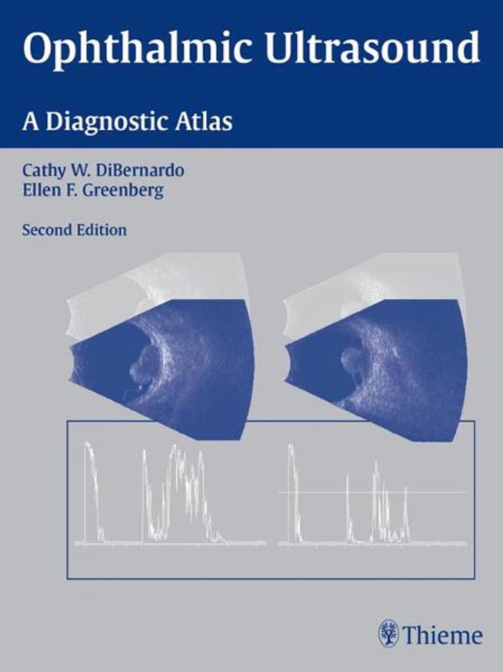 Big bigCover of Ophthalmic Ultrasound