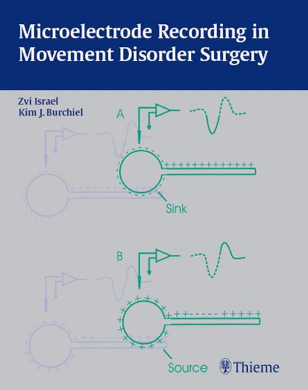 Big bigCover of Microelectrode Recording in Movement Disorder Surgery