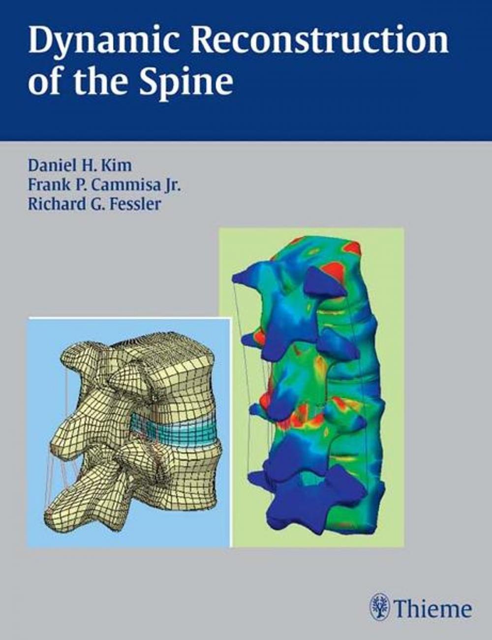 Big bigCover of Dynamic Reconstruction of the Spine