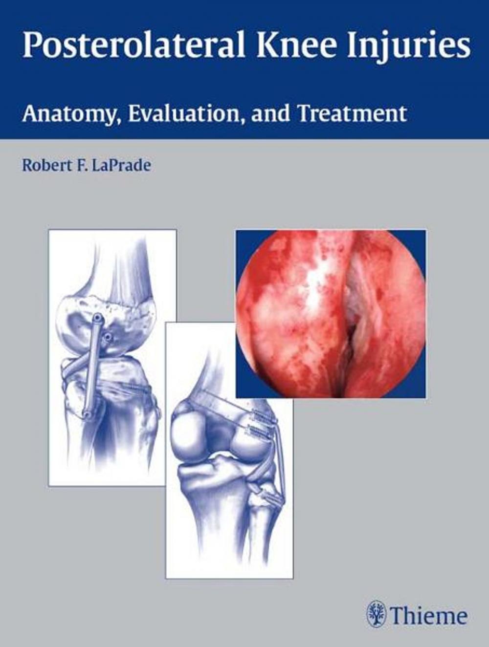 Big bigCover of Posterolateral Knee Injuries