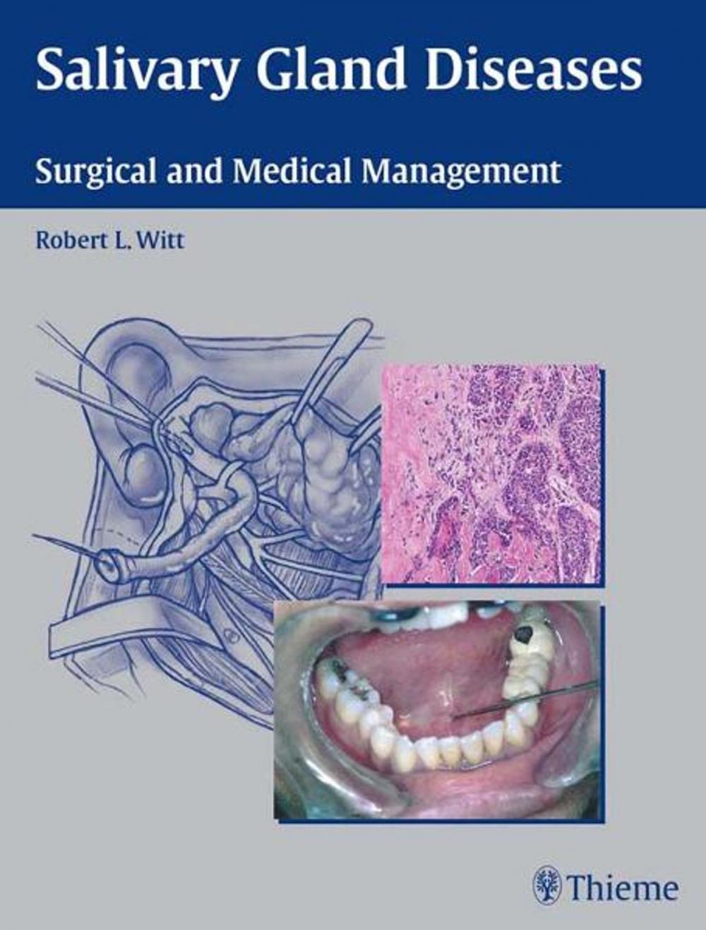 Big bigCover of Salivary Gland Diseases