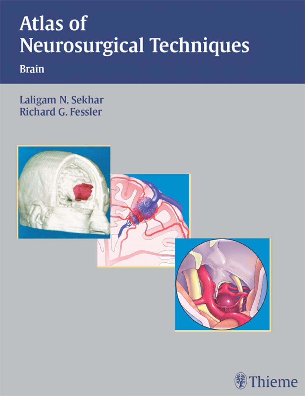 Big bigCover of Atlas of Neurosurgical Techniques