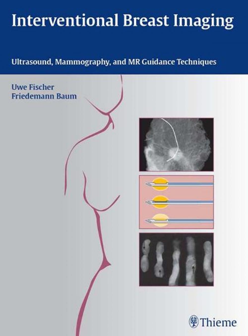 Big bigCover of Interventional Breast Imaging