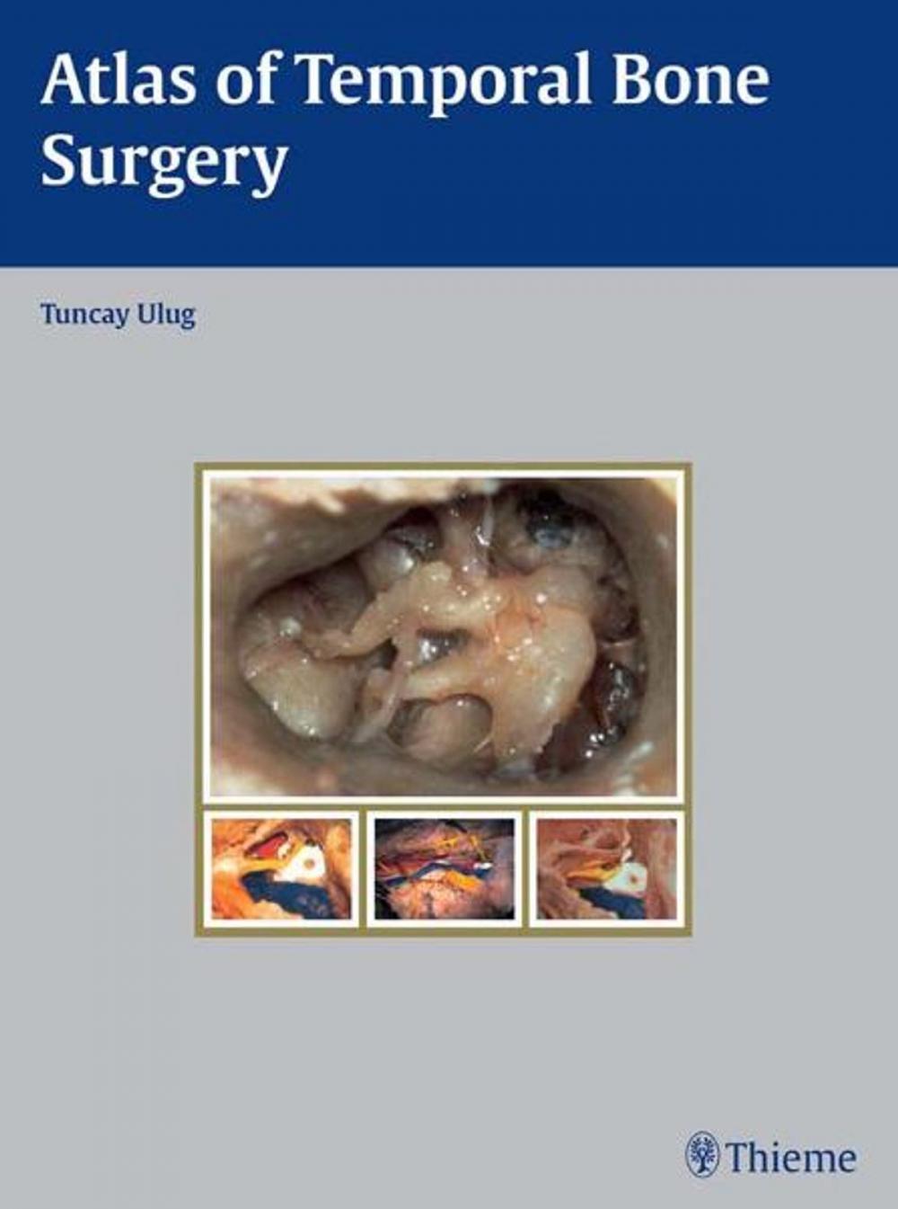 Big bigCover of Atlas of Temporal Bone Surgery