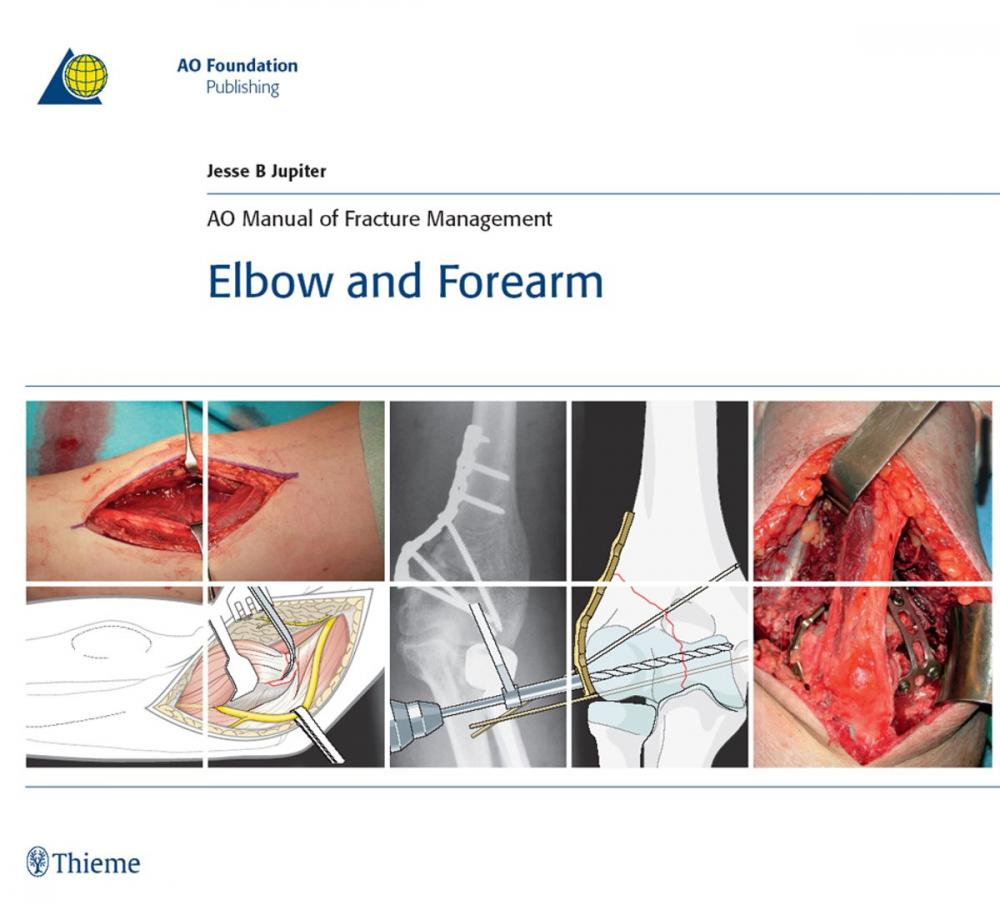 Big bigCover of AO Manual of Fracture Management: Elbow & Forearm