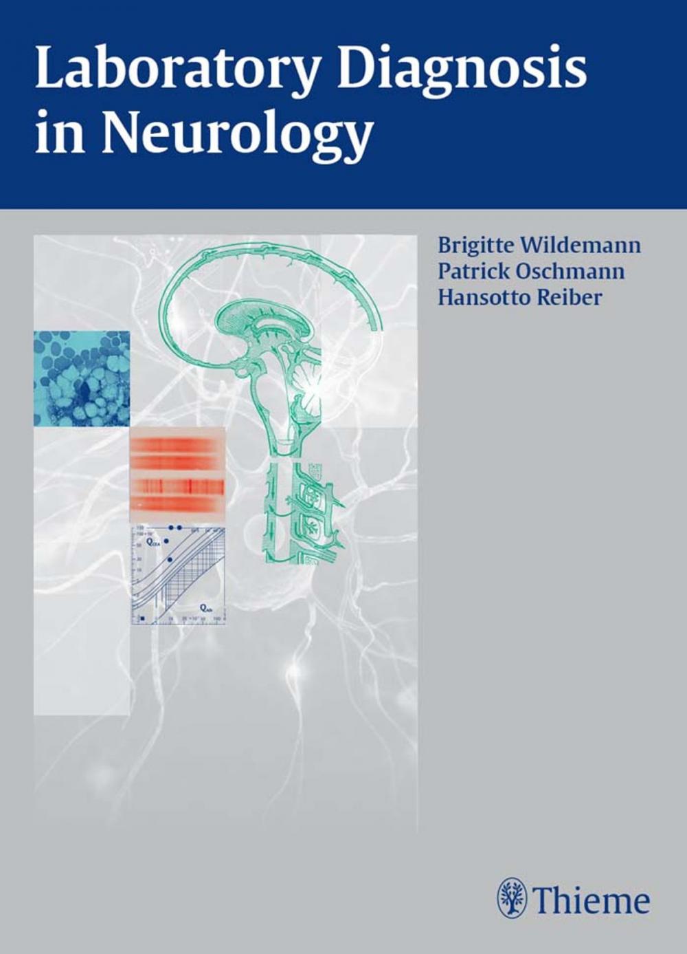 Big bigCover of Laboratory Diagnosis in Neurology