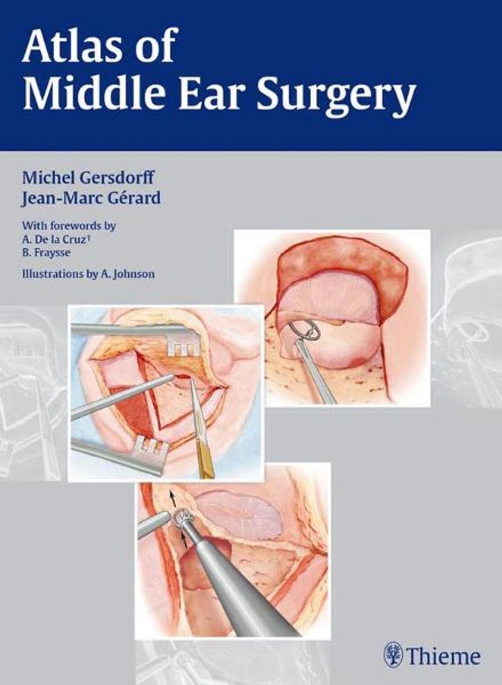 Big bigCover of Atlas of Middle Ear Surgery