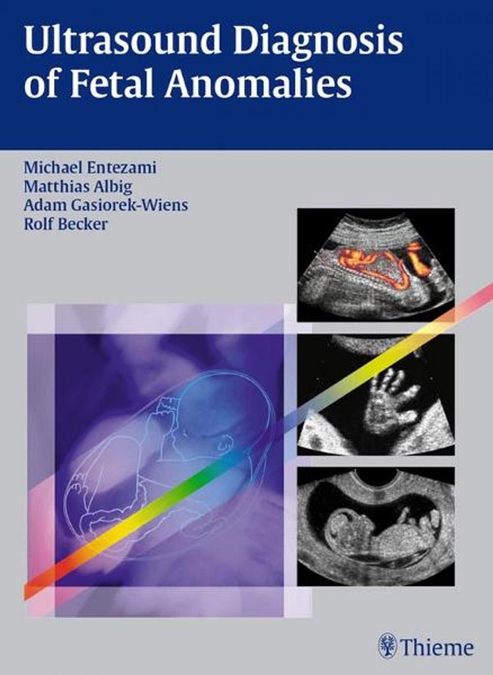 Big bigCover of Ultrasound Diagnosis of Fetal Anomalies